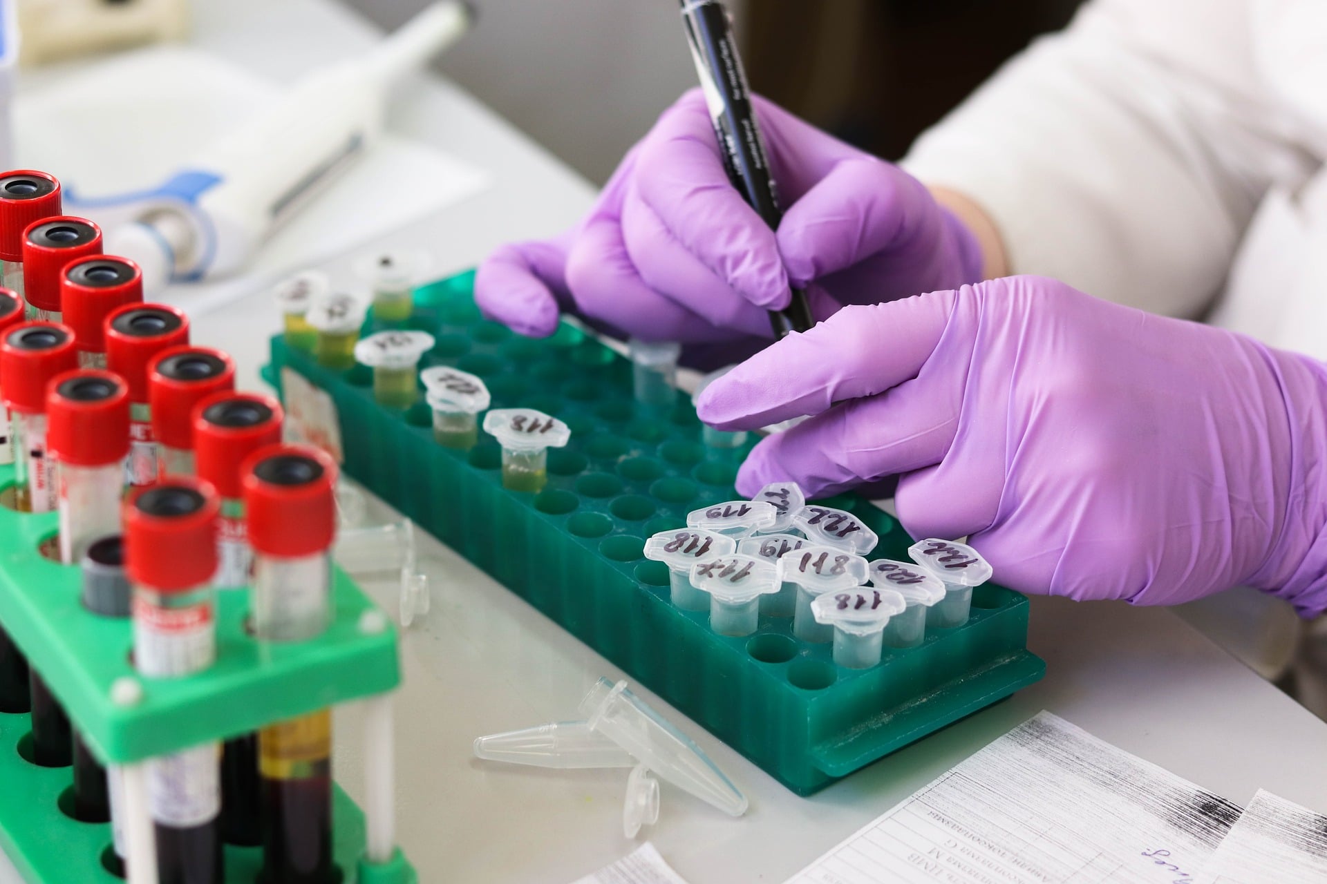 La molecola che nasconde la leucemia mieloide acuta al sistema immunitario