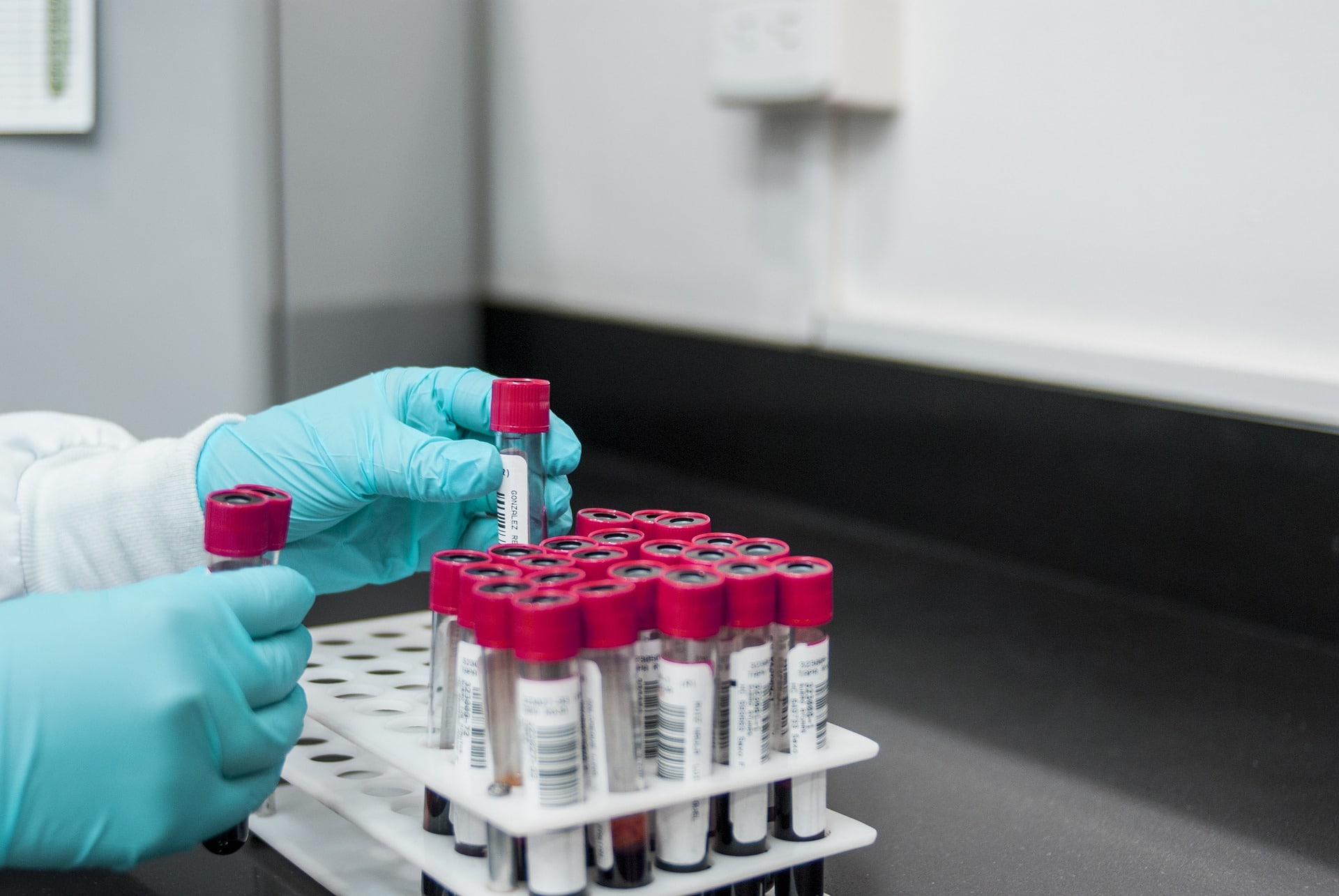Terapia genica: creato un protocollo per evitare la chemioterapia