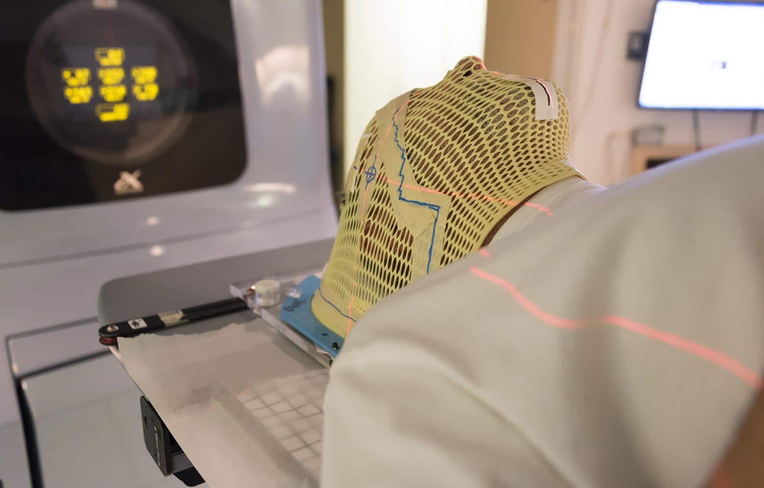 Radioterapia con maschera. Credits: Tumori del Distretto Testa e Collo