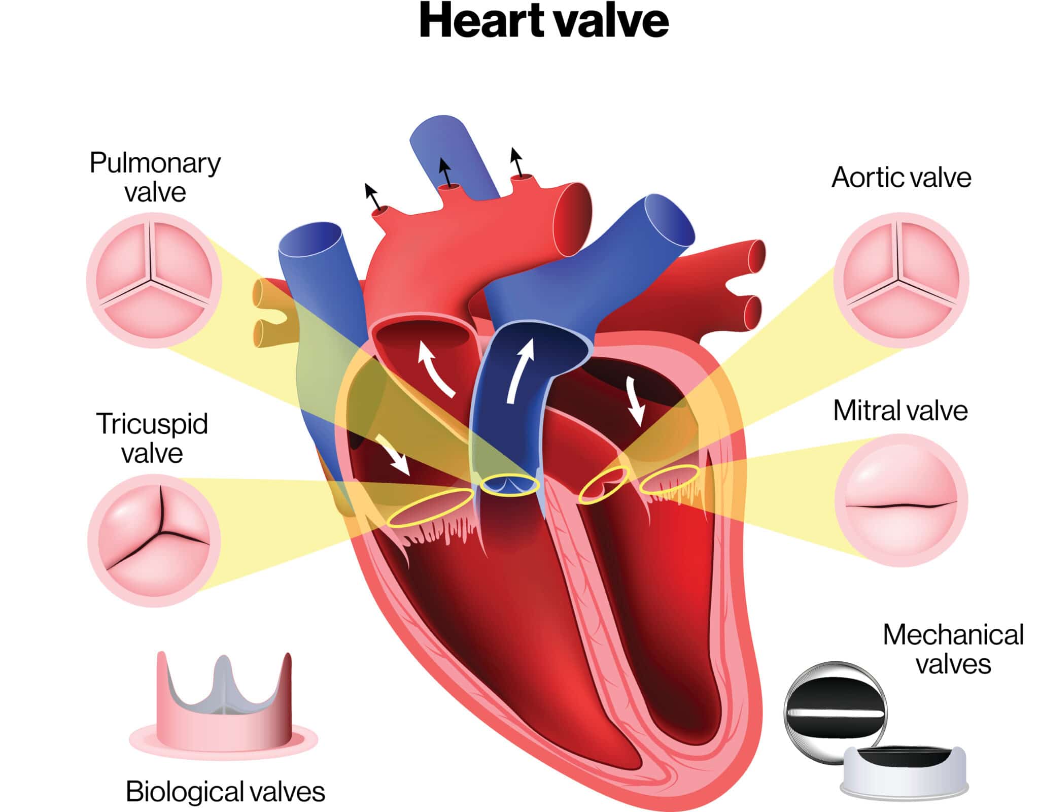 Credits: plsaravanancardiologist.com