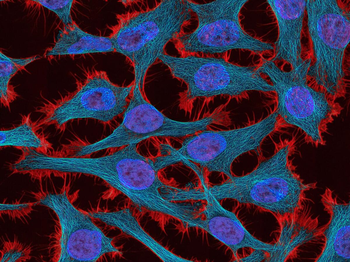 Fotodinamica: nuovo dispositivo impiantabile per terapia personalizzata - 