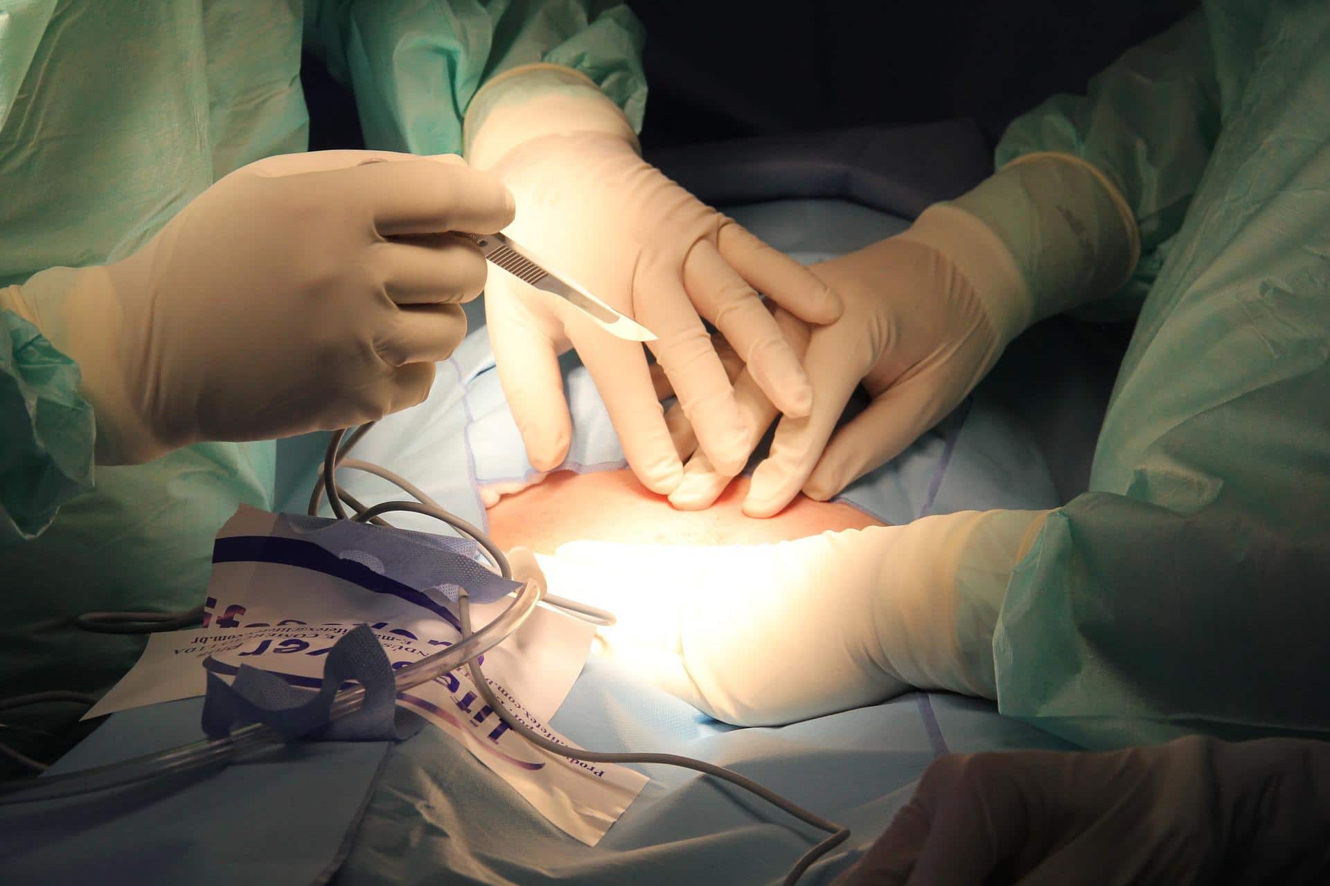 interventi estetici