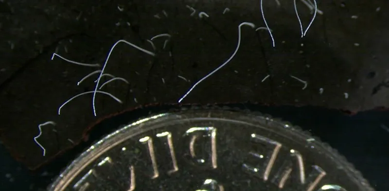 Batterio visibile ad occhio nudo