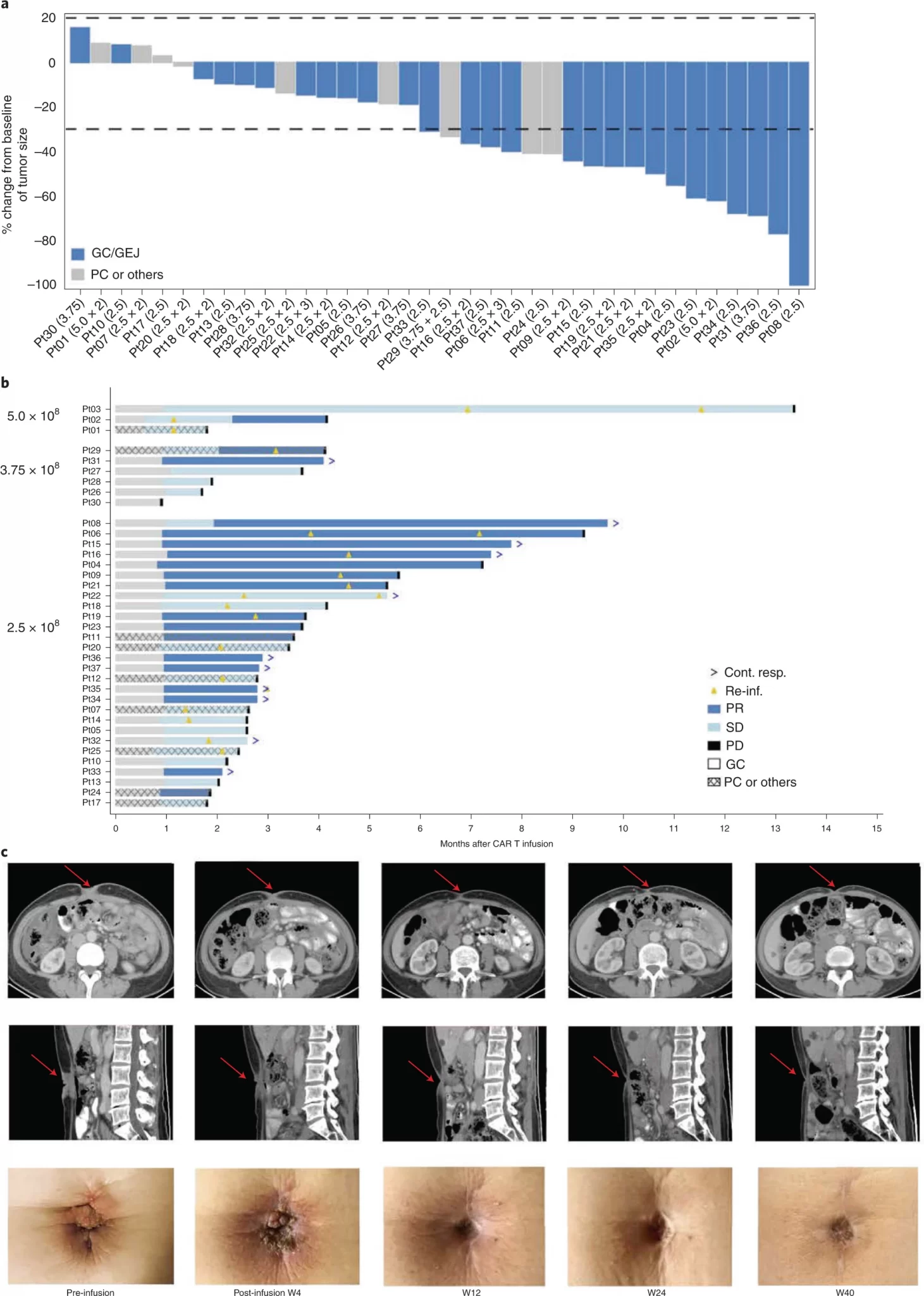 a) Variazione delle dimensioni del tumore dopo il trattamento nei pazienti con lesioni bersaglio. b) Le migliori risposte di ciascun paziente valutate secondo RECIST 1.1 dal team di ricercatori, in seguito raggruppate per dose. c) Lesione tumorale dell'om