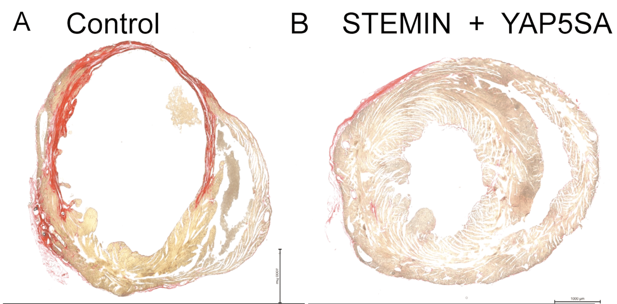 Riparazione ottenuta in vivo su topi senza e con la somministrazione dei fattori STEMIN e YAP5SA. Credits: The Journal of Cardiovascular Aging
