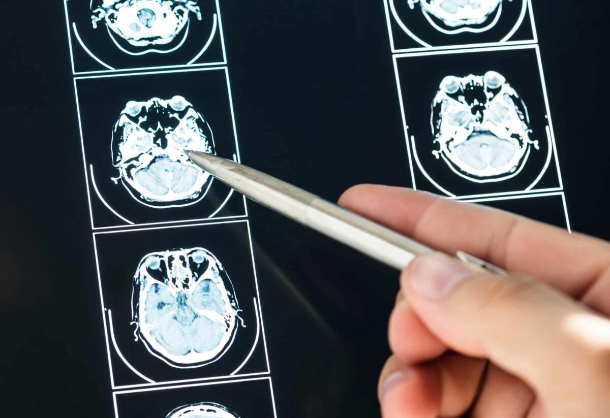 Glioblastoma multiforme: una nuova terapia genica - 