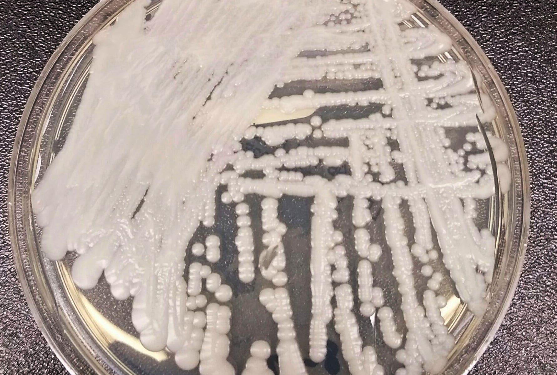 Shawn Lockhart - This media comes from the Centers for Disease Control and Prevention's Public Health Image Library (PHIL), with identification number #21796. Immagine di pubblico dominio.