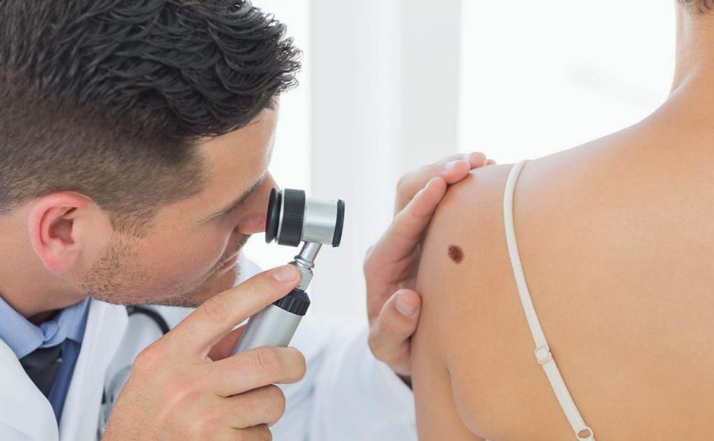 Dottore che controlla un possibile melanoma dovuto all'esposizione alle tradizioni UV.