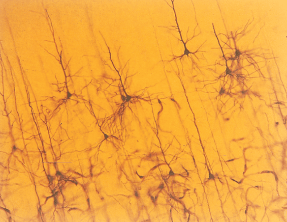 Metodo di Golgi: non sempre gli errori in laboratorio portano a delle reazioni devastanti. Qualche volta ti possono procurare un Premio Nobel.
