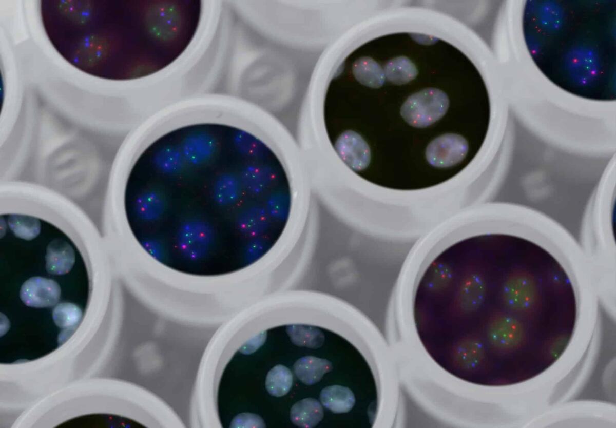 Genoma: 'vernice spray' mette in evidenza la materia oscura - Credits: NCI