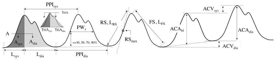 Tipico segnale fotopletismografico con relativi indici PPG - Postoperative Pain Assessment Indices Based on Photoplethysmography Waveform Analysis