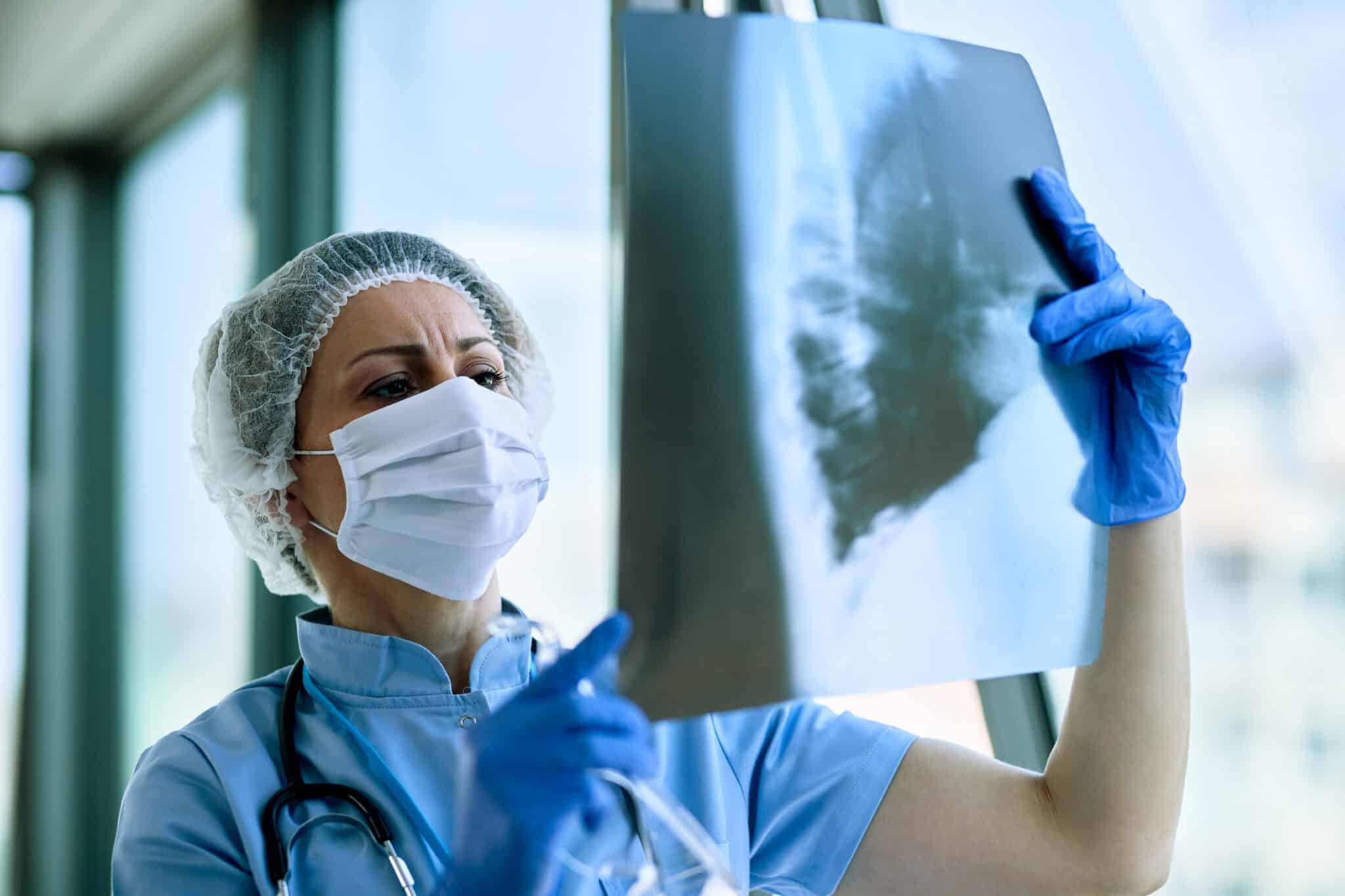 Cancro ai polmoni