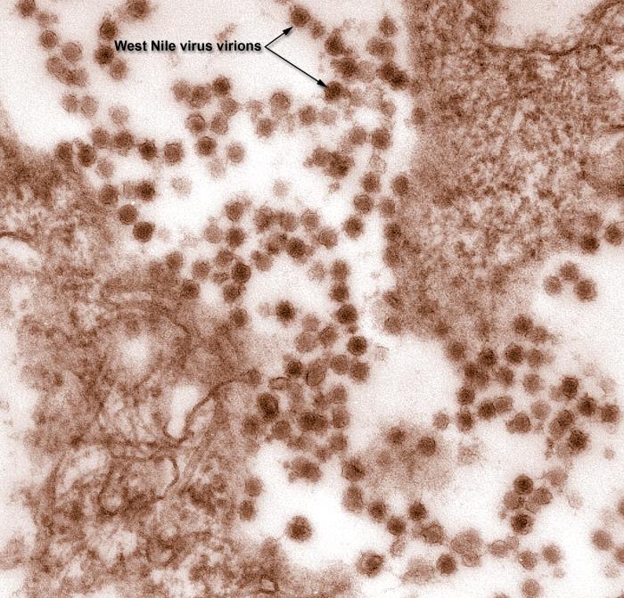 Immagine ottenuta al microscopio elettronico a trasmissione (TEM) colorata digitalmente che ha rivelato la presenza di particelle virali del virus del Nilo occidentale (WNV), in un isolato che è stato coltivato in una coltura cellulare. Credits: CDC Centr
