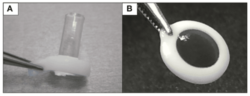 Due esempio di cornea artificiale realizzata con polimeri purificati - Artificial Cornea: Past, Current and Future Directions, 2018