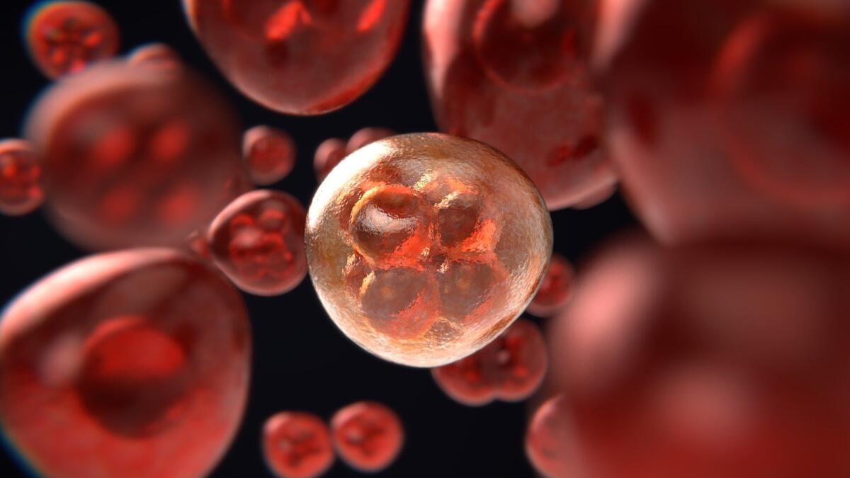 Leucemia mieloide acuta: dalla biologia alla terapia - 