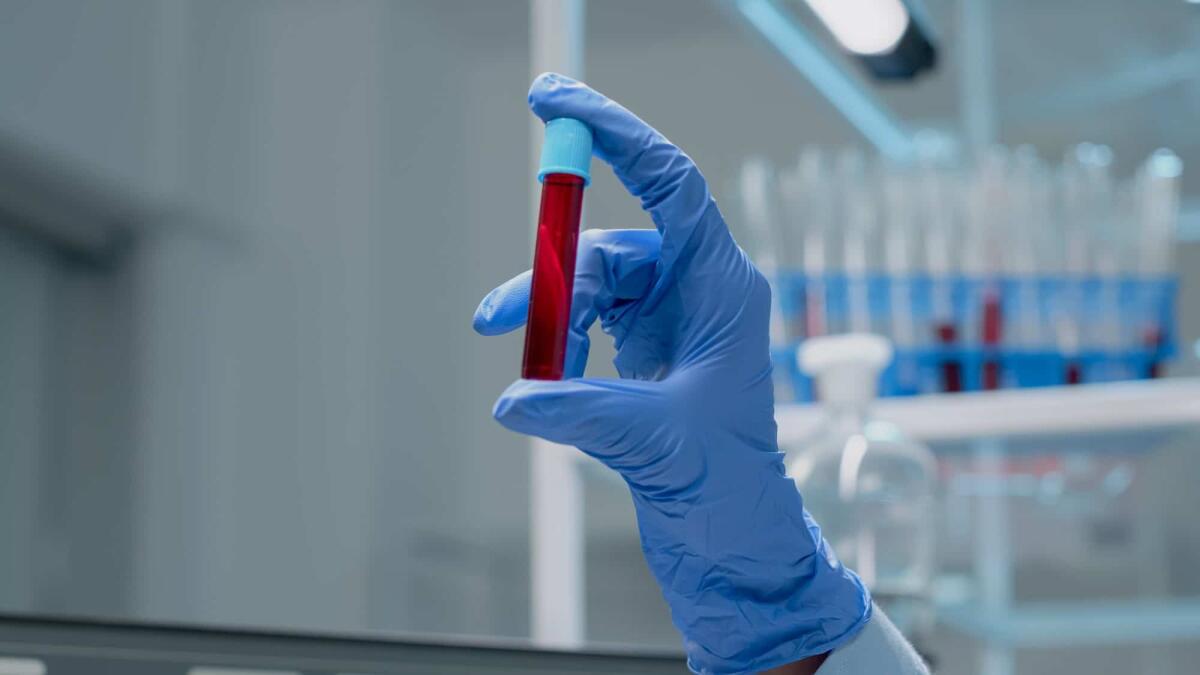 Gruppi sanguigni: gli scienziati scoprono il nuovo Er - 