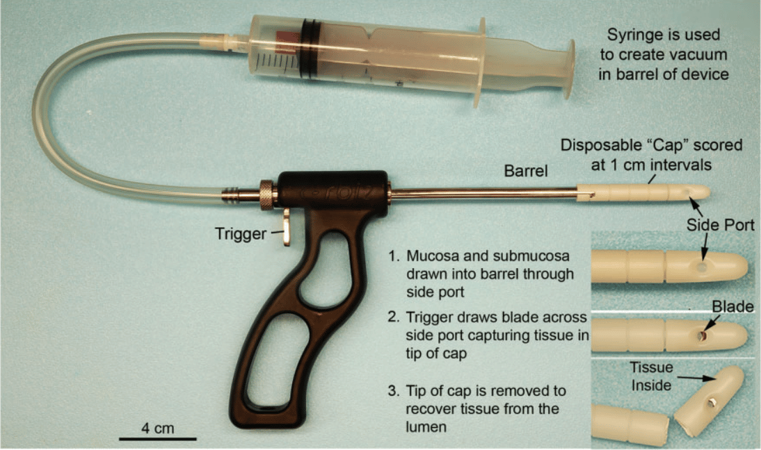 Device per biopsie rettali. Credits: Diagnosis of Hirschsprung desease, Seattle, 2020