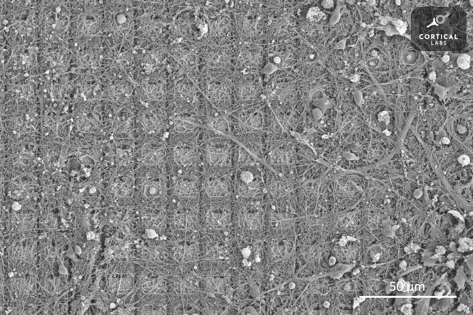 Immagine al microscopio elettronico a scansione di una cultura neurale che sta crescendo da più di 6 mesi su un array con multielettrodi ad alta densità - Credits: Cortical Labs