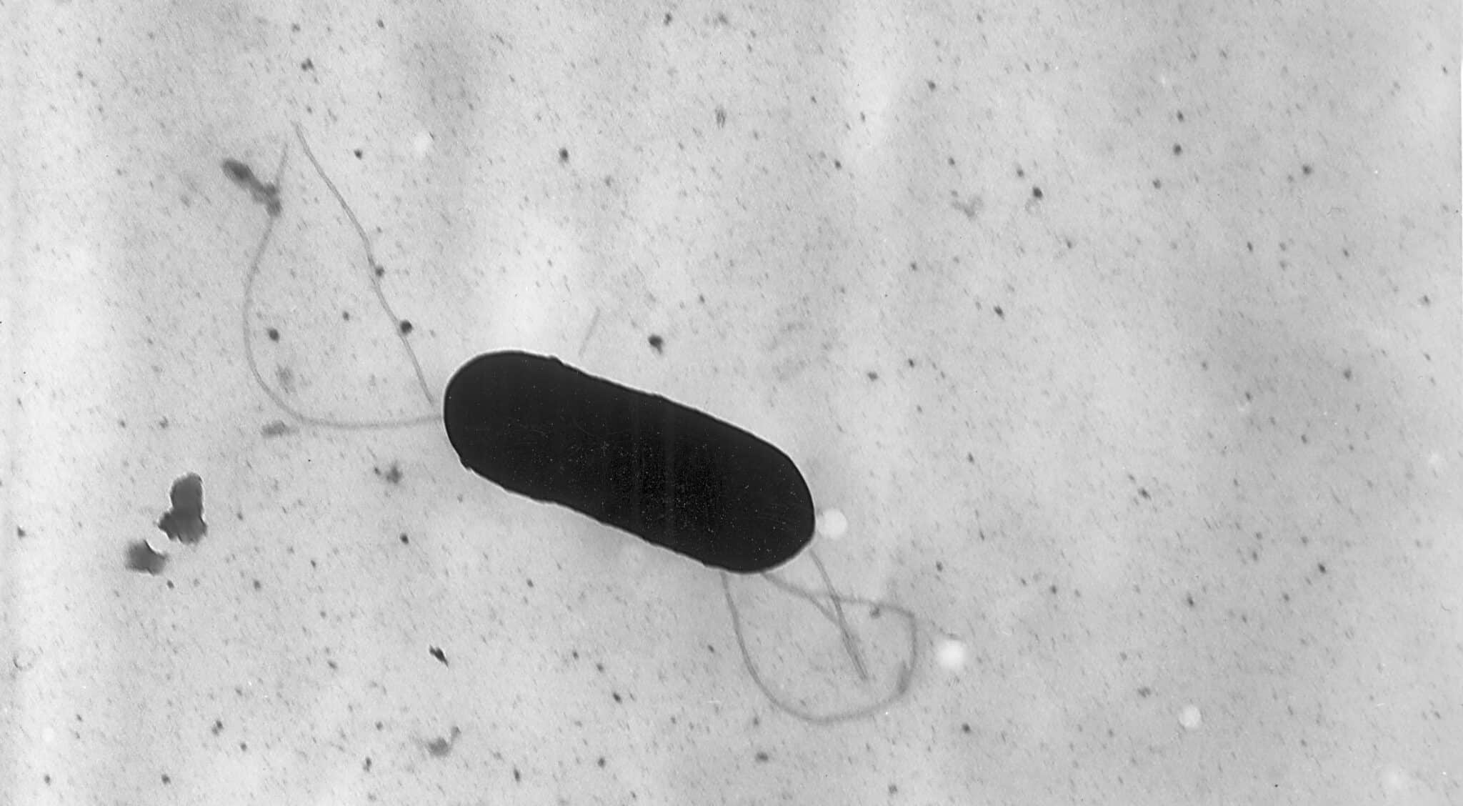 Fotografia ottenuta con il microscopio elettronico del batterio Listeria monocytogenes.