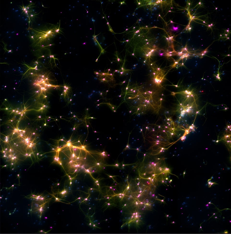 Dishbrain al microscopio. Un'immagine di microscopia di cellule neurali in cui i marcatori fluorescenti mostrano diversi tipi di cellule. Il verde segna i neuroni e gli assoni, il viola segna i neuroni, il rosso segna i dendriti e il blu segna tutte le ce