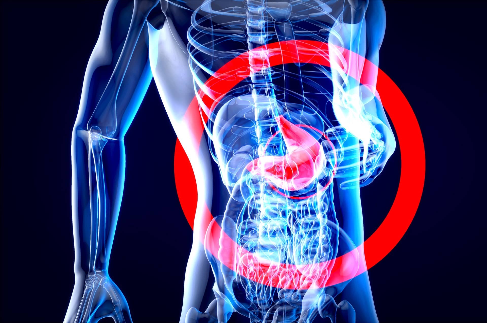 Helicobacter pylori colonizzazione pH acido