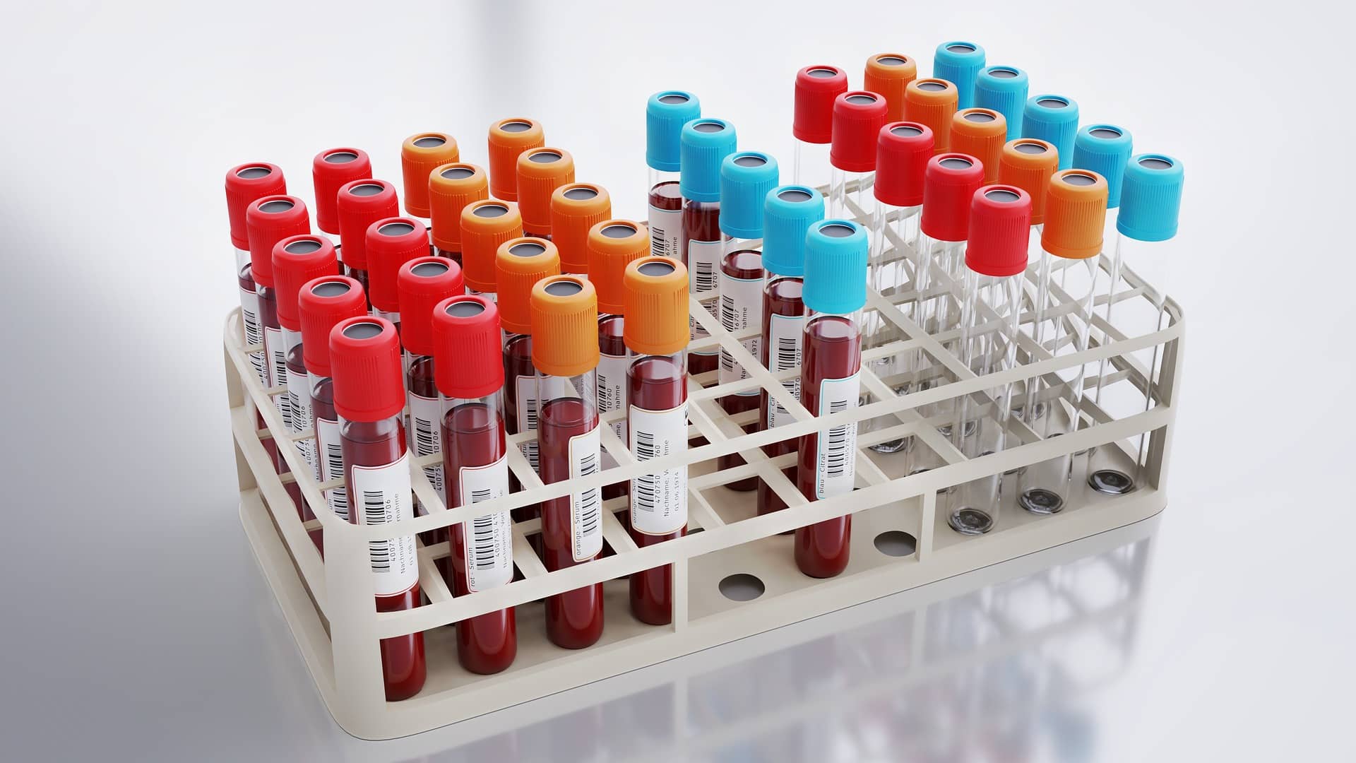 diabete gestazionale prelievo sanguigno