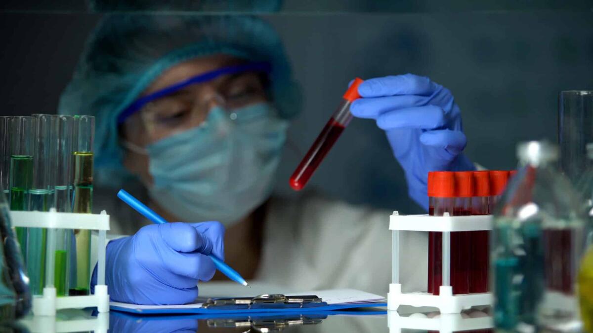Vaccino contro HIV: per la prima volta suscitati anticorpi specifici per l'essere umano - Scientist checking tube with blood analysis and making notes, epidemic outbreak