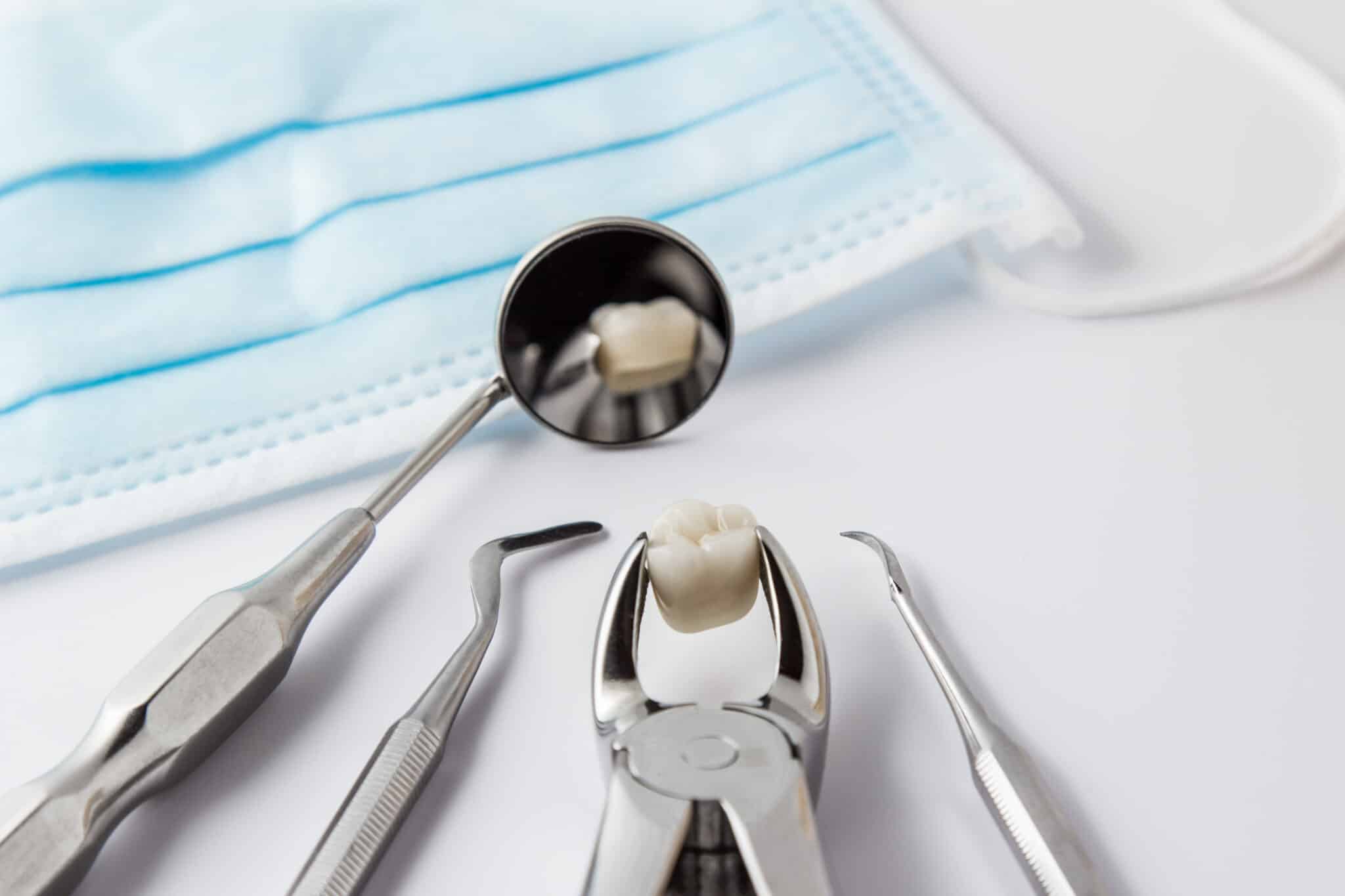L'estrazione del dente