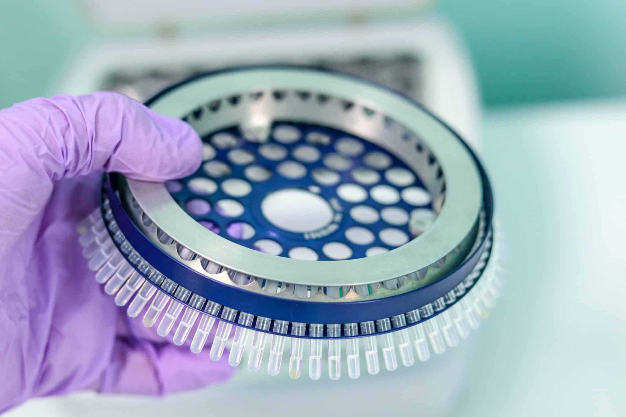 Vaccino contro l’HIV
