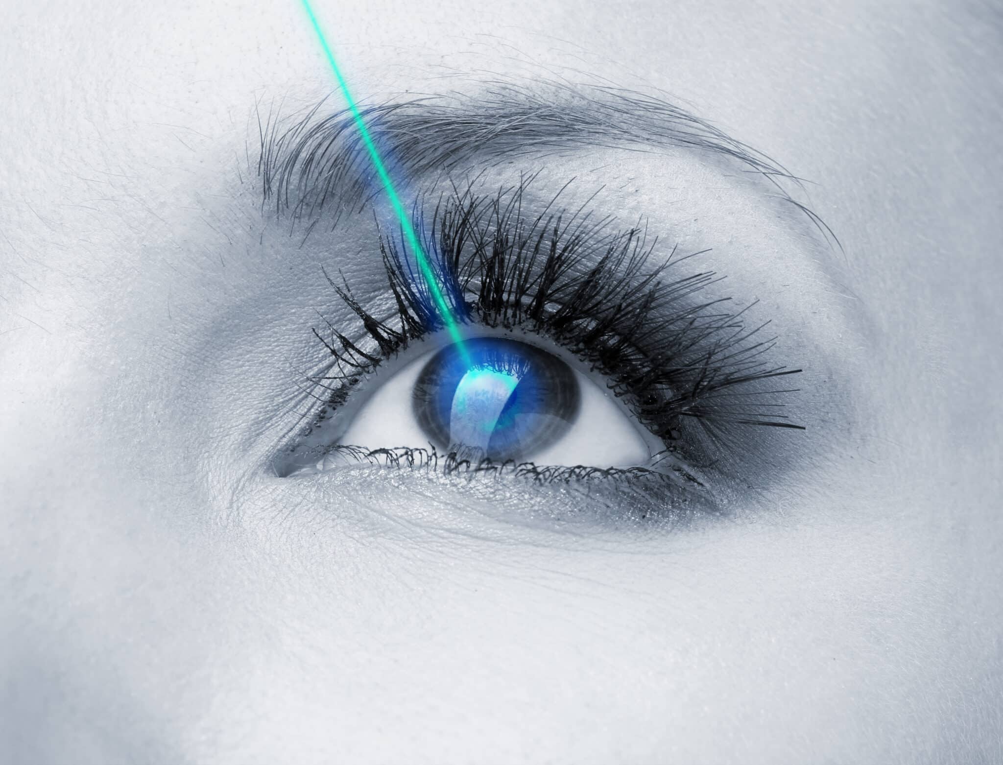Laser  agli occhi.