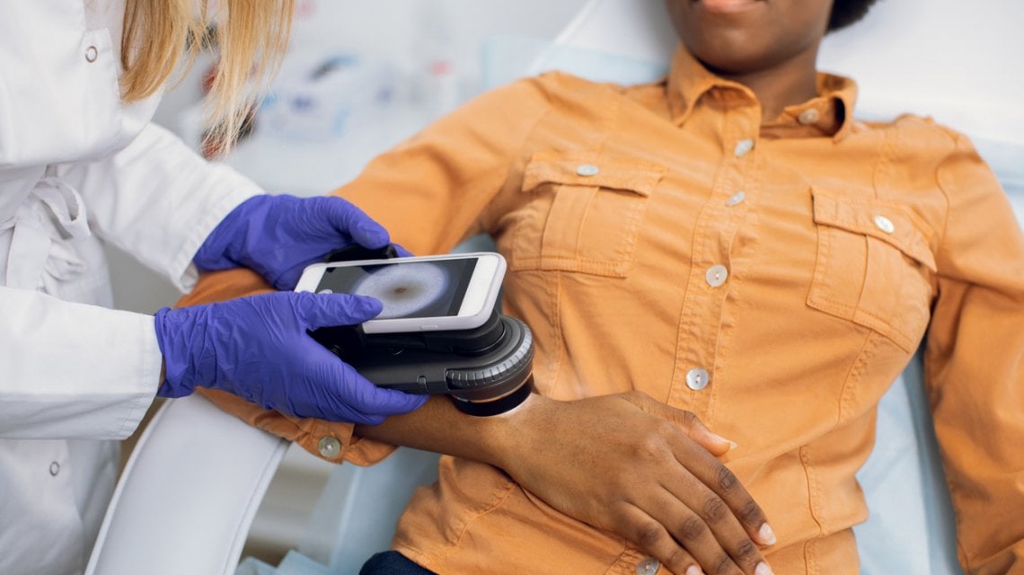 Esempio di dermatoscopio digitale per il monitoraggio della dermatite atopica. Credits: Repubblica
