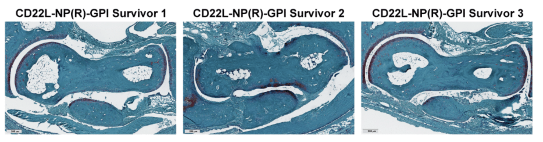 Istologia dell'articolazione della caviglia di topi con artrite reumatoide trattati con CD22L-NP(R)-GPI - Credits: ACS Nano