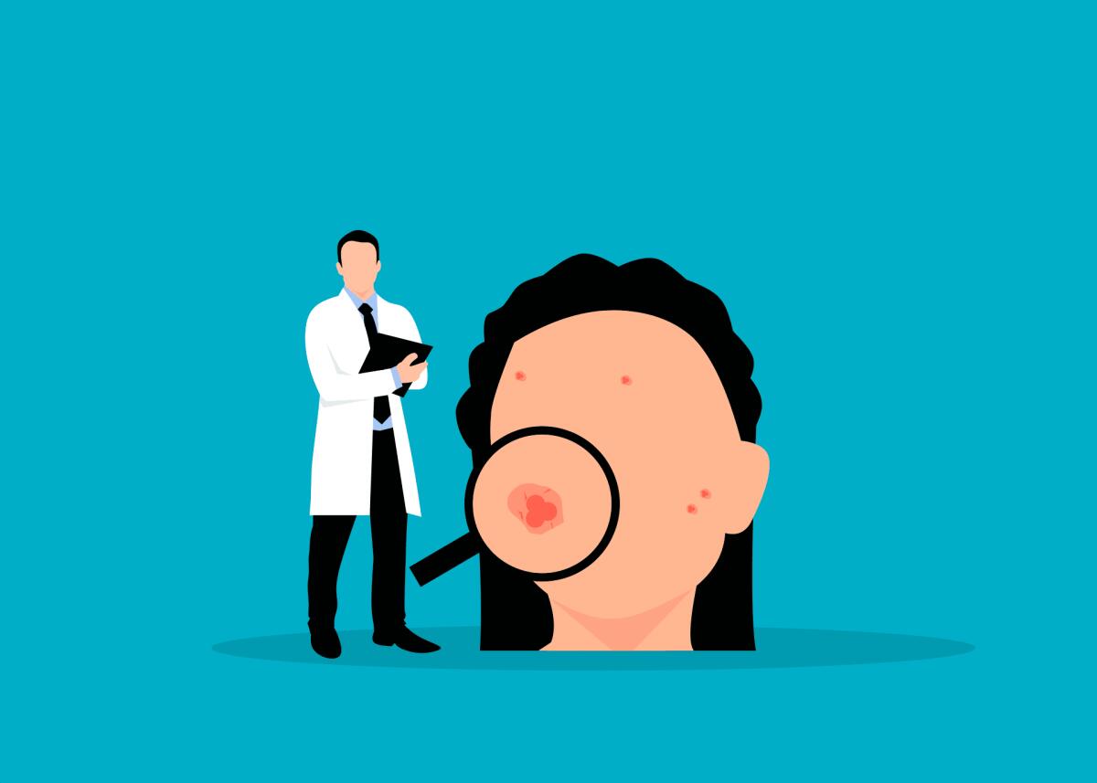 Lupus eritematoso sistemico: individuato un nuovo approccio terapeutico - 