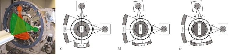 Apparecchiatura DSTC con due sistemi di misura indipendenti. a) 1a generazione. L’angolo di sistema tra i due sistemi di misurazione è di 90°. b) 2a generazione. Per aumentare l’SFOV del rilevatore (B), è stato scelto un angolo di sistema più ampio di 95°