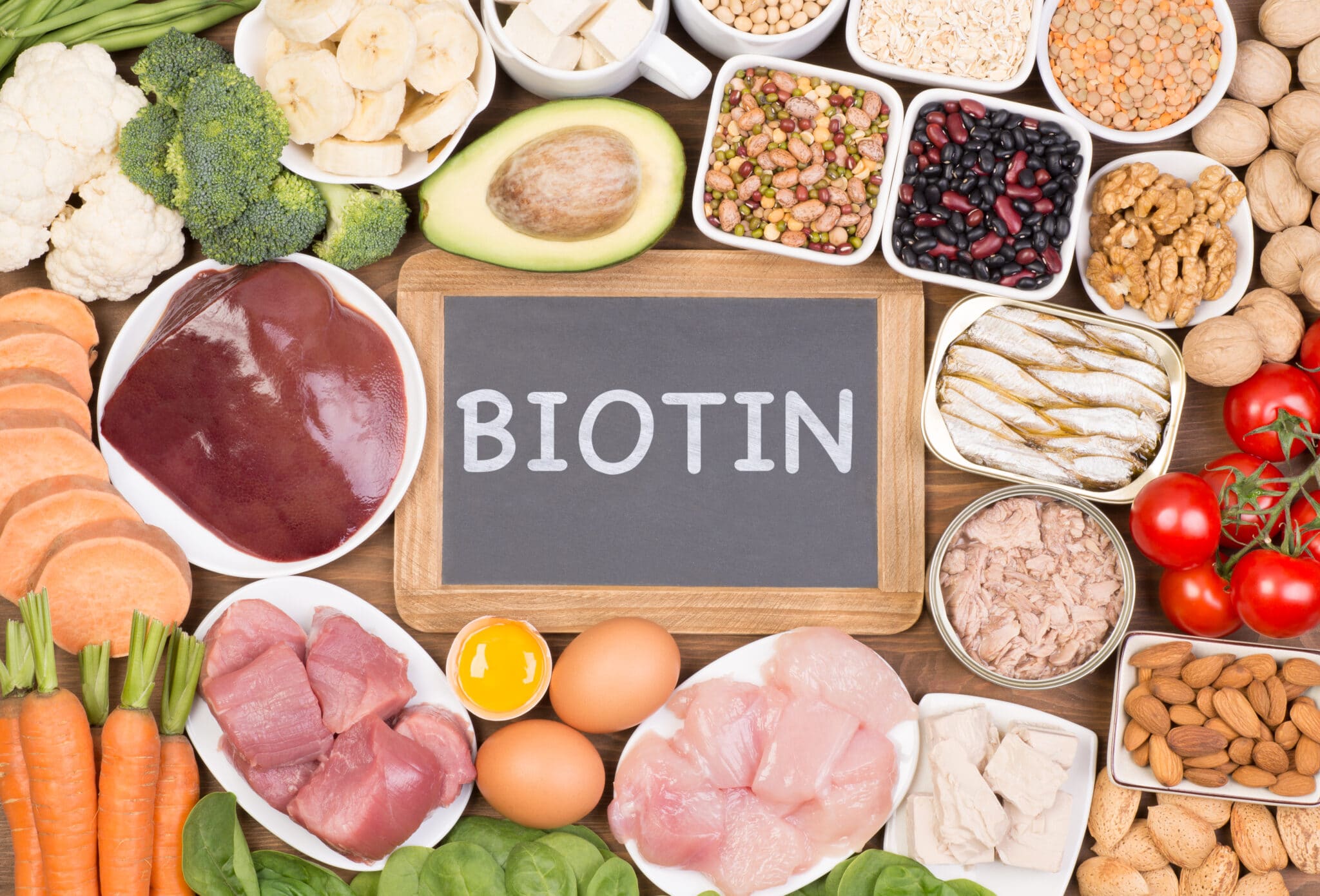 biotina