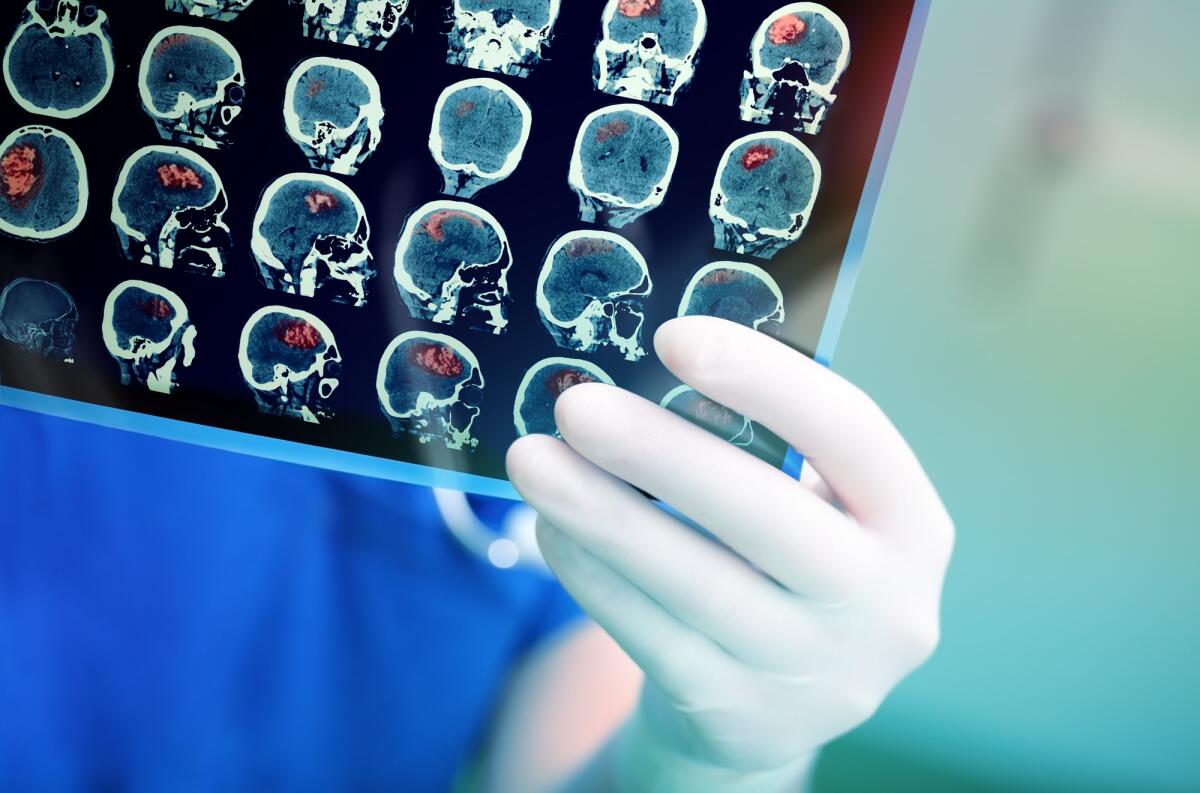 Imaging fotoacustico: novità sulle funzioni cerebrali - imaging fotoacustico