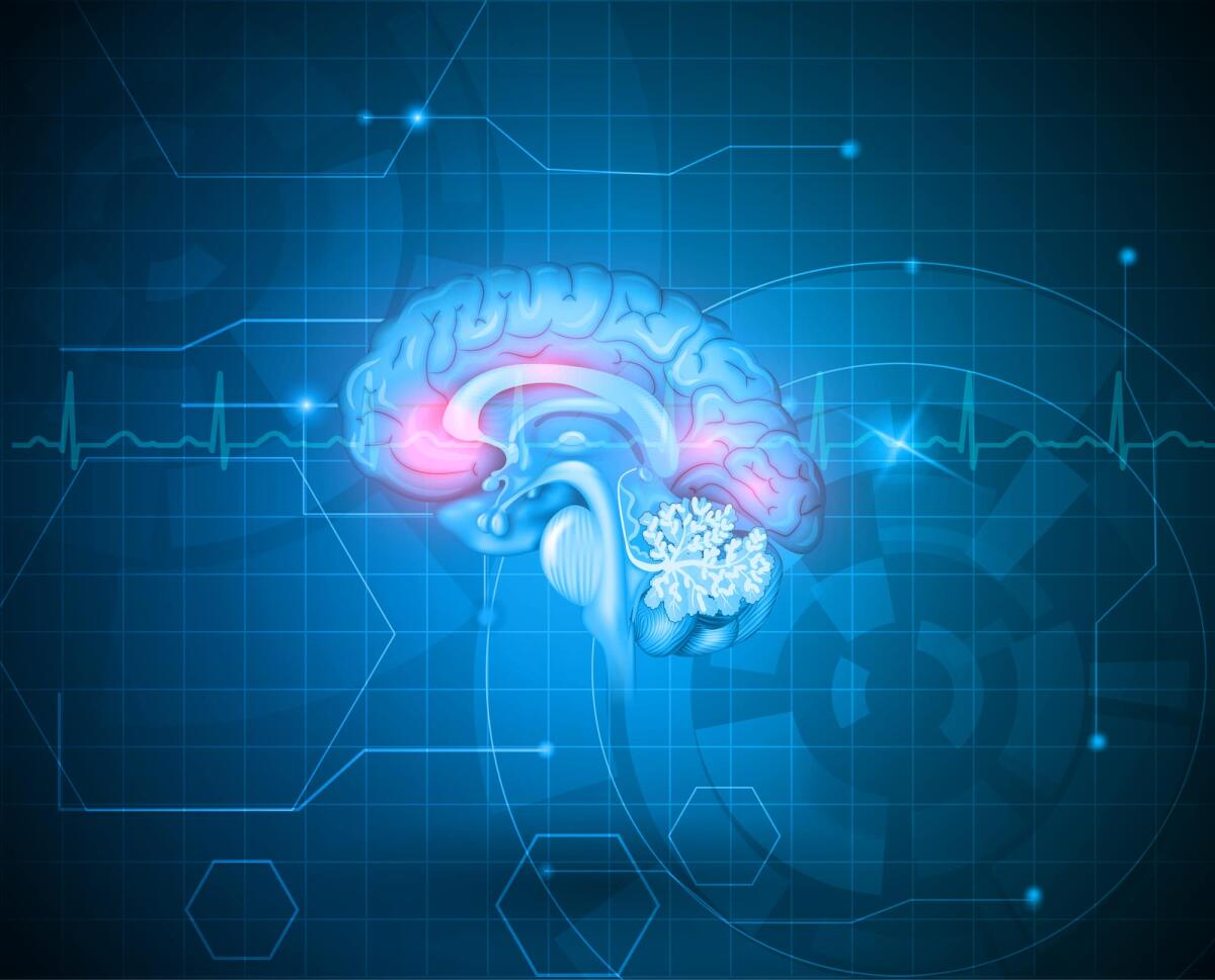 Ictus: infezione virale dormiente può innescarlo - 