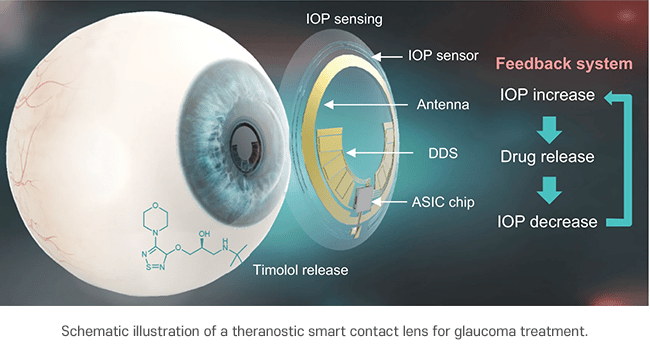 In figura è visibile la nuova lente a contatto ideata per la diagnosi ed il monitoraggio del glaucoma - Credits: POSTECH