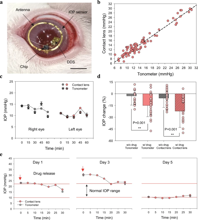 Controllo della pressione intraoculare in vivo con lenti a contatto intelligenti nei conigli neozelandesi - Credits: Nature