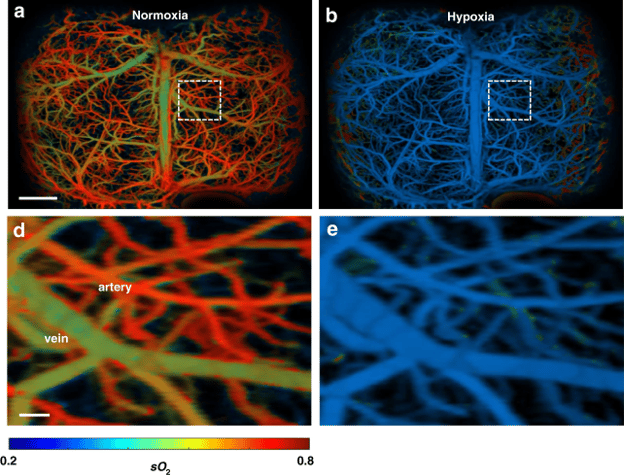 Imaging UFF-PAM dell'ossigenazione del sangue di tutto il cervello nei topi in condizioni normali (normossia) a sinistra e con una riduzione drastic dell'ossigeno (ipossia) a destra - Credits: Light: Science and Applications