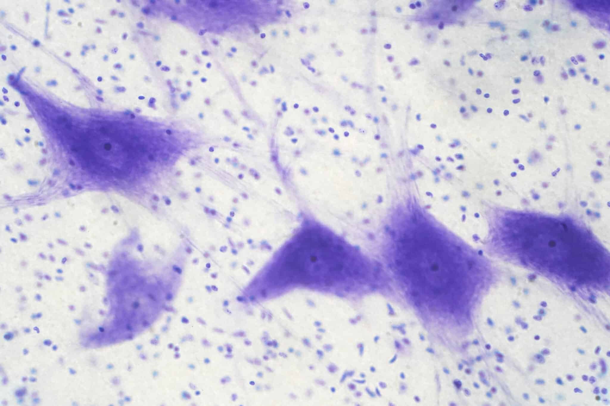 Cellule neuronali viste al microscopio.