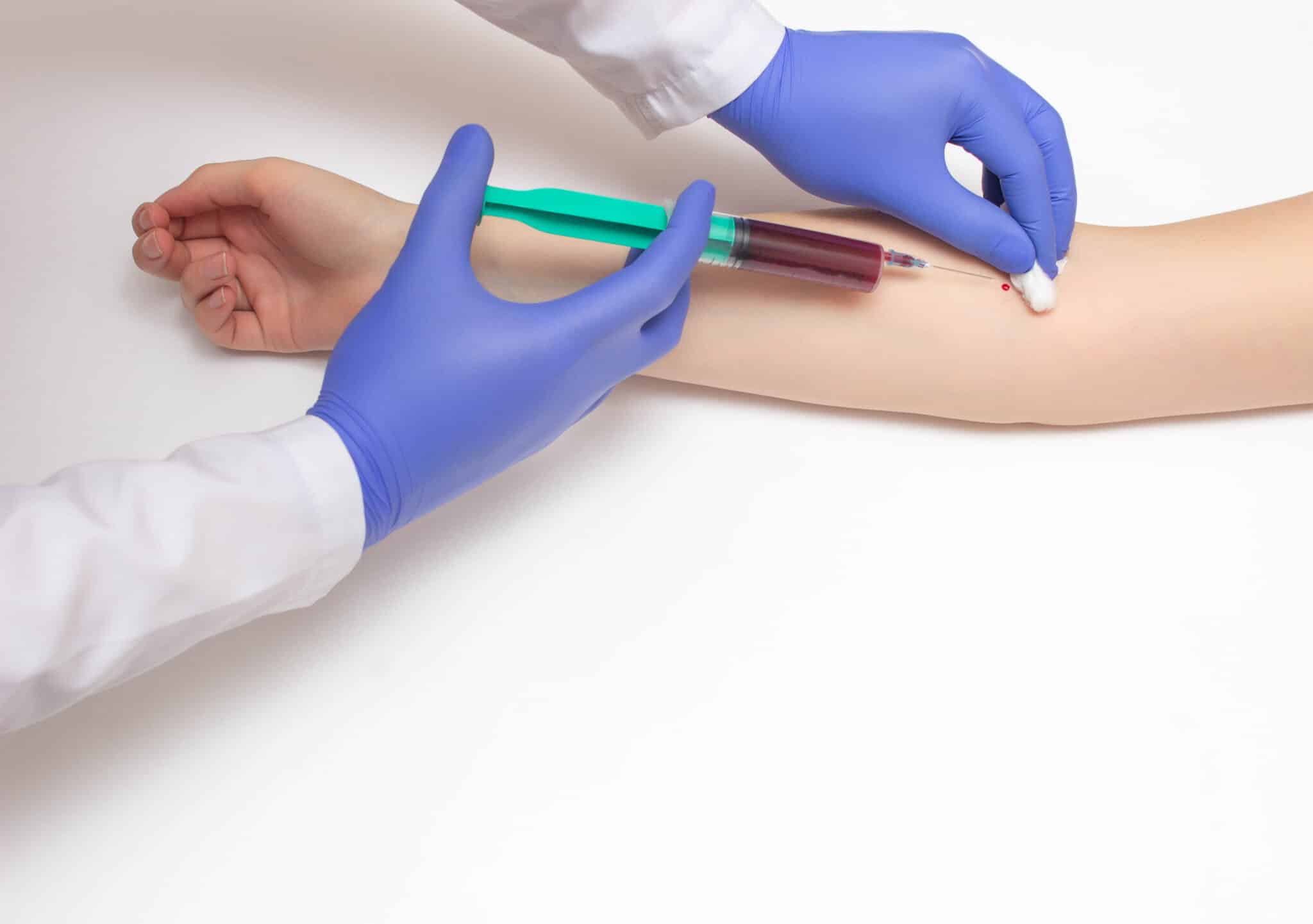 analisi del sangue per colesterolo buono