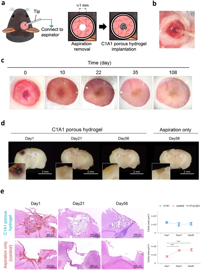 Istituzione di un modello di lesione cerebrale traumatica e impianto di un hydrogel poroso C1A1 nel cervello del topo - Credits: Nature