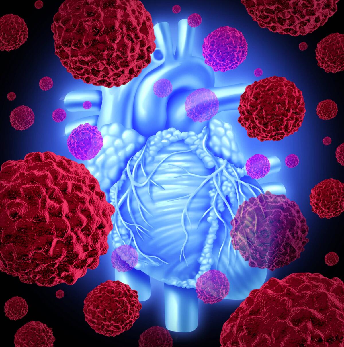 Angiosarcoma cardiaco: cos'è il tumore al cuore ultra raro - Human heart cancer health care medicine concept with the inner human organ and red cancer cells forming tumors spreading in the body as a malignant disease that needs chemotherapy or heart surgery.