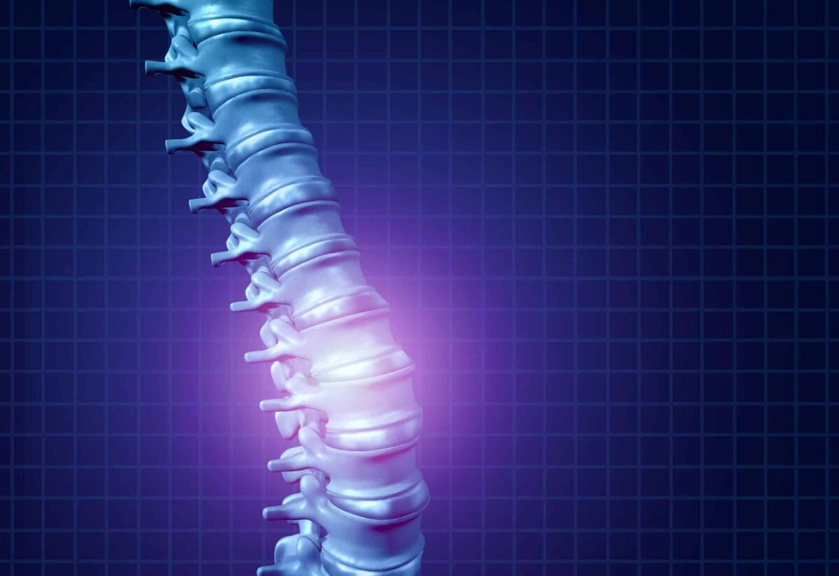 Mal di schiena: cos'è, diagnosi e cura - Back spine pain and human backache as a skeleton showing the spine and vertebral column in glowing highlight as a medical health care concept for spinal health and therapy as a 3D illustration.