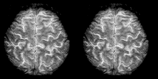 In foto una scansione con fMRI ad alta risoluzione del cervello umano - Credits: Bioquark
