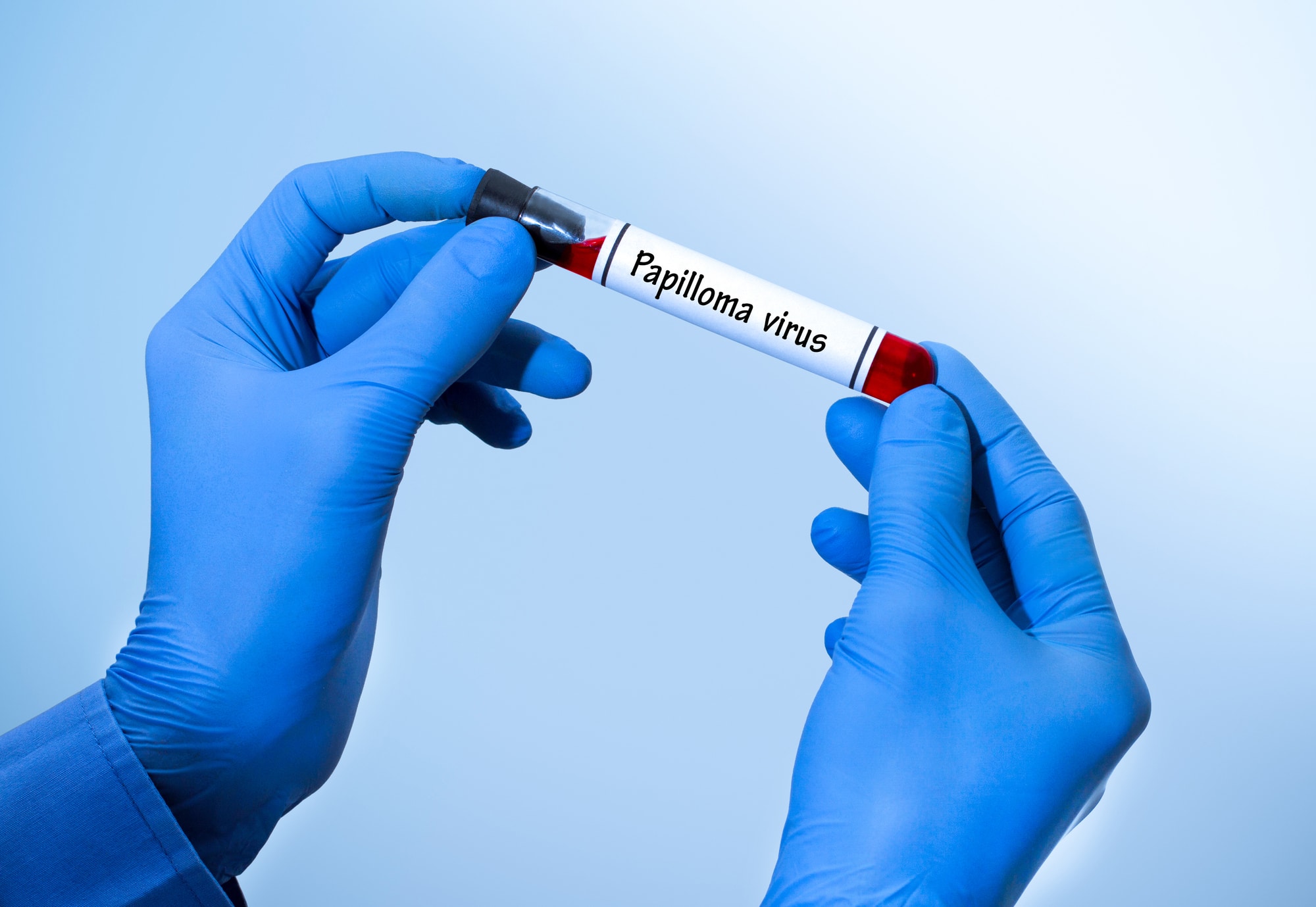 Vaccino Hpv: la copertura del 95% è sempre più lontana