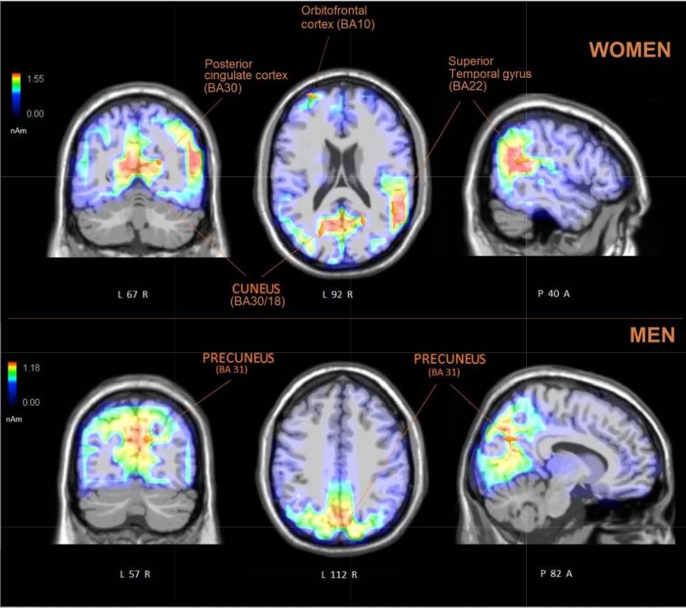 Credits - PubMed Central (NIH, NCBI) "Women are better at seeing faces where there are none: an ERP study of face pareidolia"