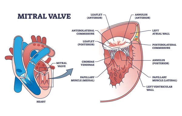 Valvola mitrale