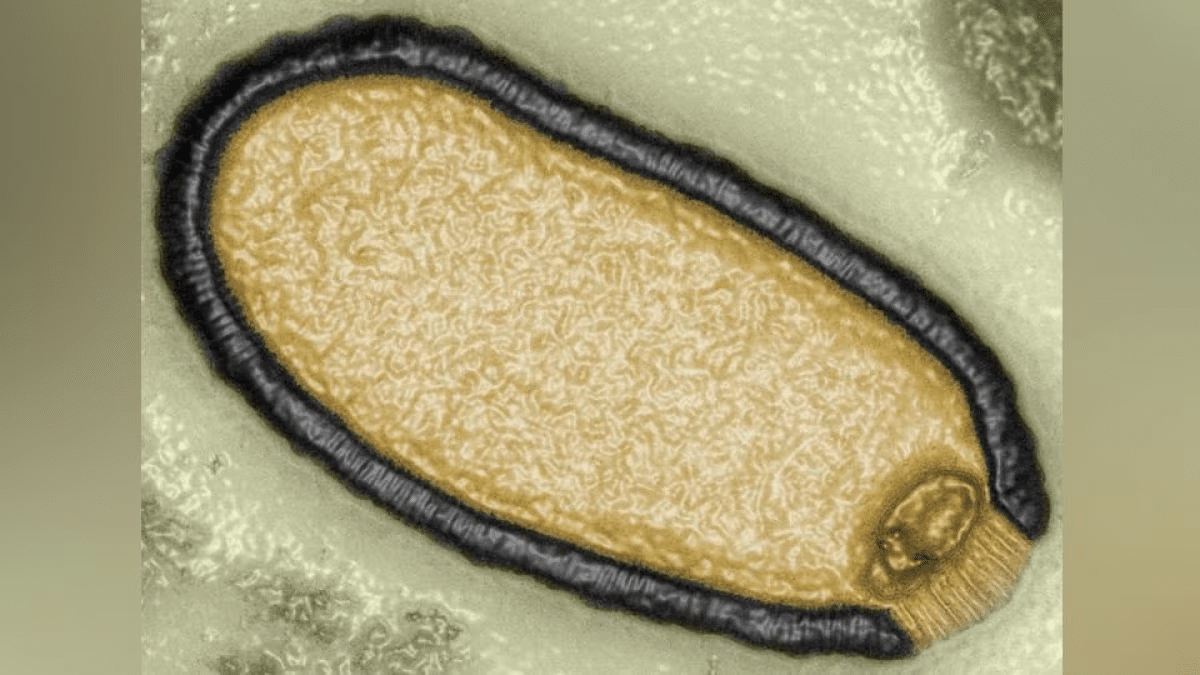 Un virus di 30mila anni, simile a quello di 50mila anni recentemente risvegliato. Credit: Jean–Michel Claverie/IGS/CNRS–AMU